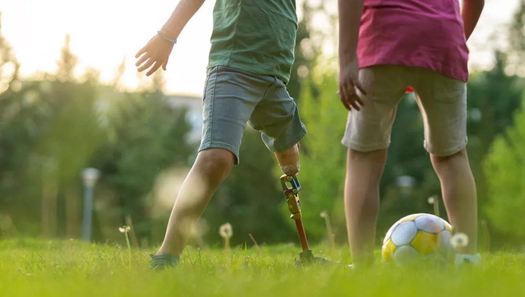 PlayaRaya boy with prosthetic leg playing soccer J2