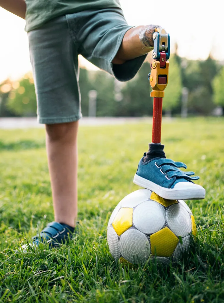 PlayaRaya boy with soccer ball and prosthetic leg J2